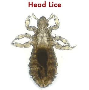 Natural Head Lice Treatment